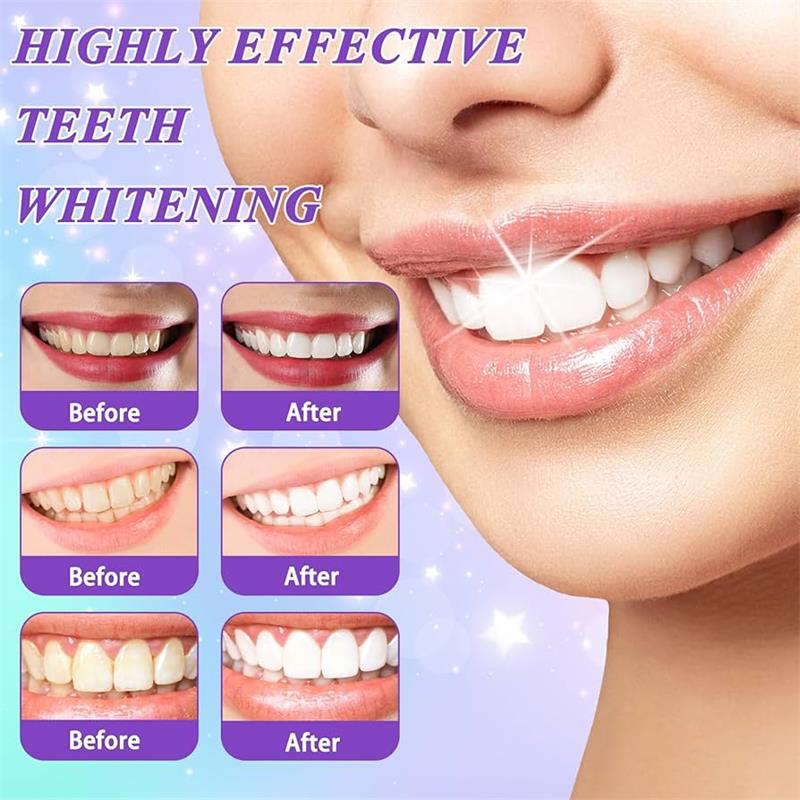 9D Mor Diş Beyazlatıcı Diş Mac - Teeth Whitening Toothpaste incelemesi ve fiyatı