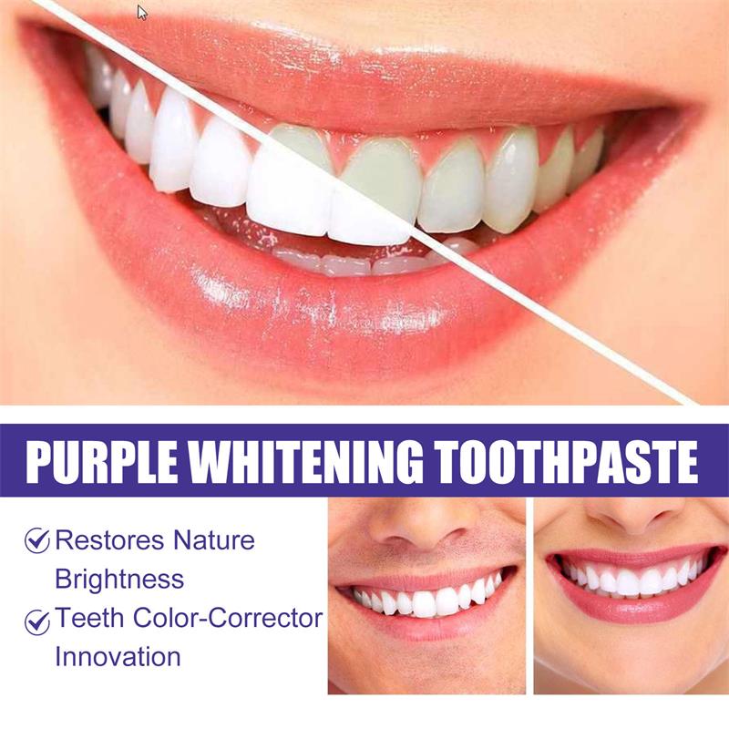 9D Mor Diş Beyazlatıcı Diş Mac - Teeth Whitening Toothpaste incelemesi ve fiyatı