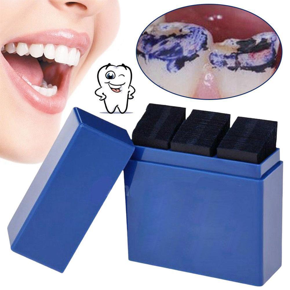 300 yaprak diş eklemleme kağıd - Teeth Whitening Kit Professional incelemesi ve fiyatı
