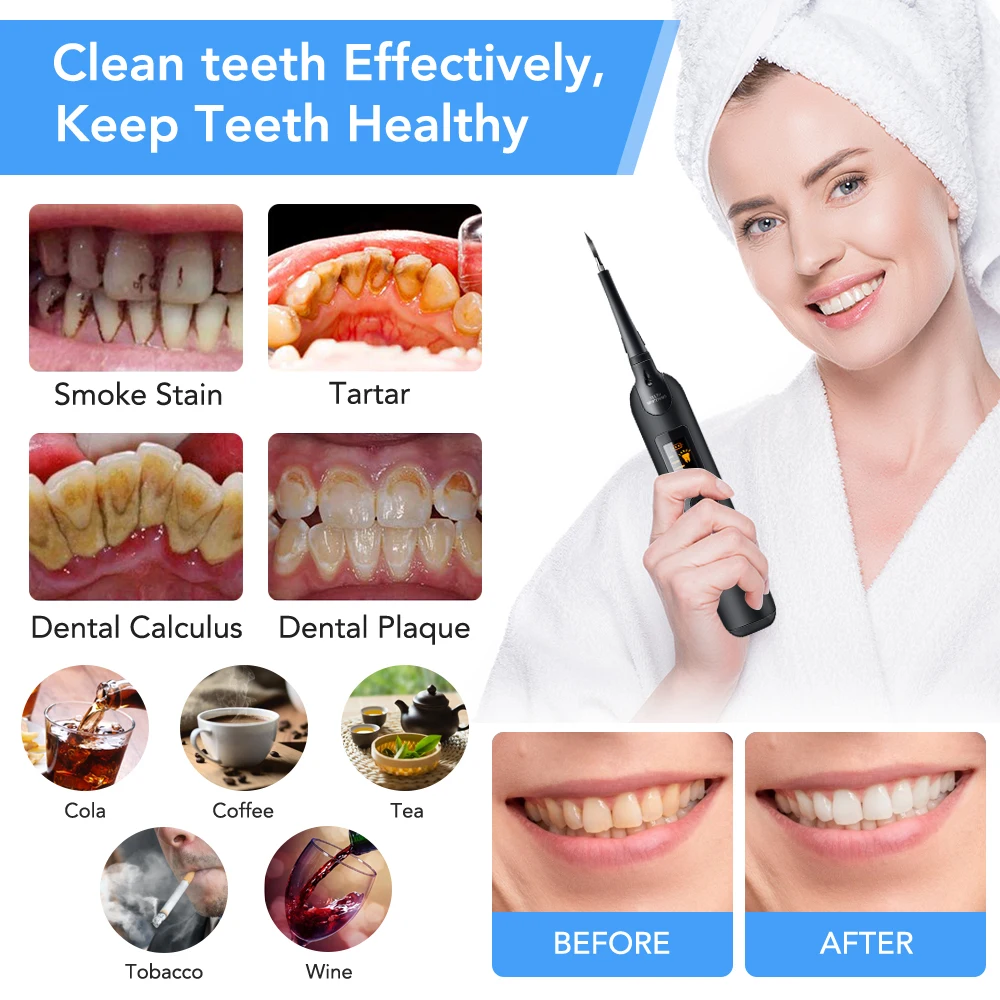 Elektrikli Diş Ölçekleyici Diş - Teeth Whitening Toothbrush incelemesi ve fiyatı