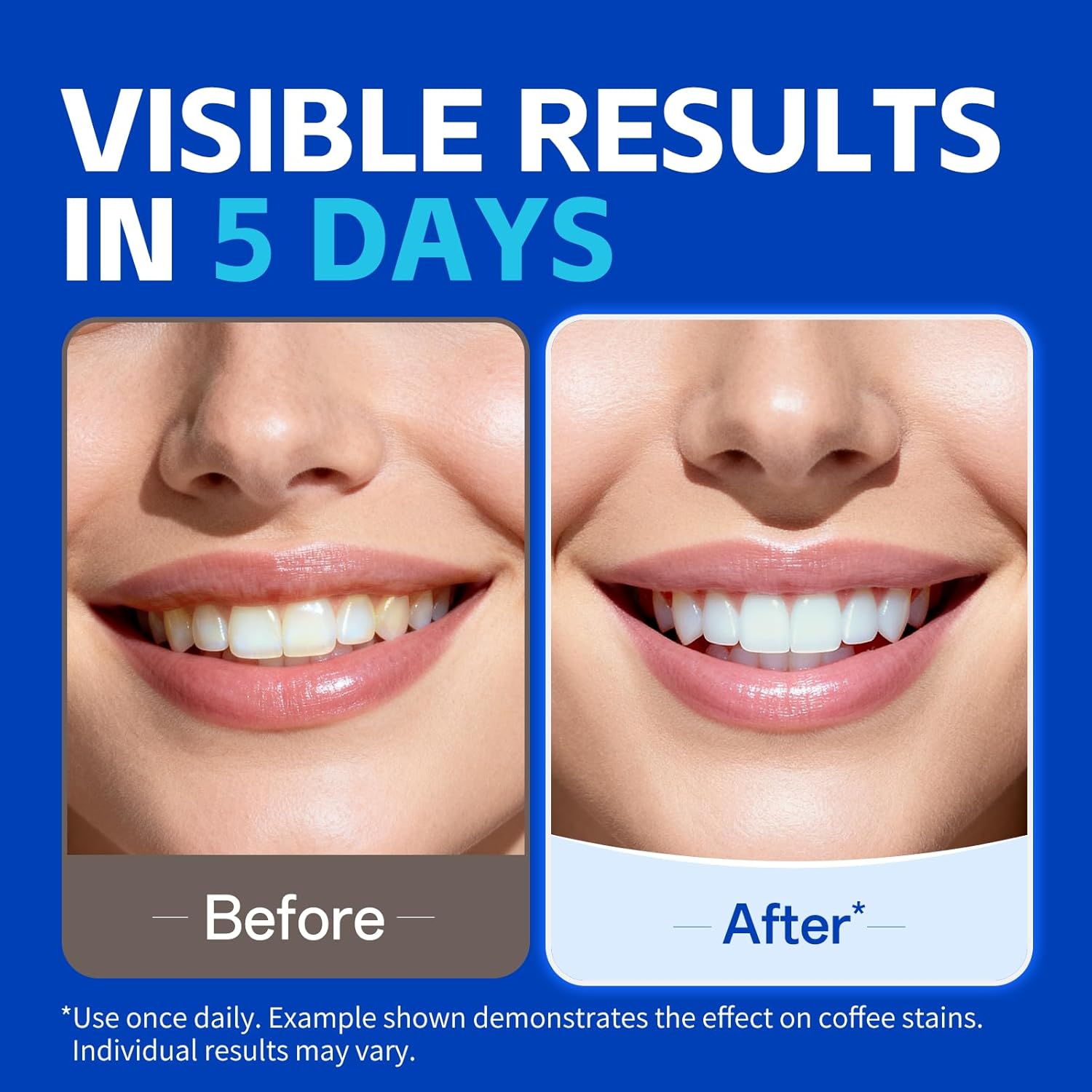Daha Beyaz Görünümlü Bir Gülüm - Teeth Whitening Strips Permanent incelemesi ve fiyatı
