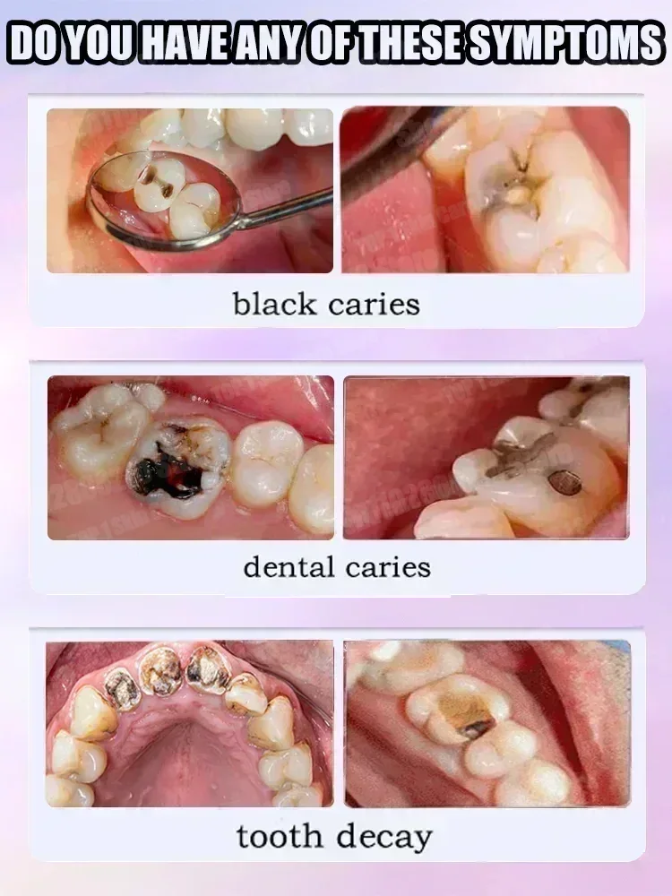 Sıcak satışlar En çok satan, B - Teeth Whitening Toothpaste incelemesi ve fiyatı