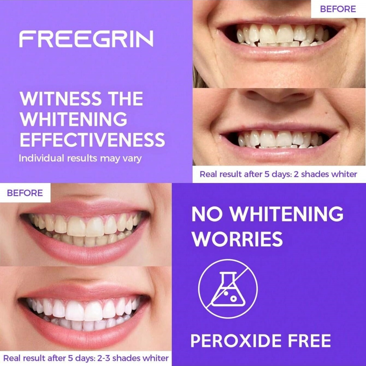 Deluxe Beyazlatma Diş Çıkartma - Teeth Whitening Gels Used By Dentists incelemesi ve fiyatı