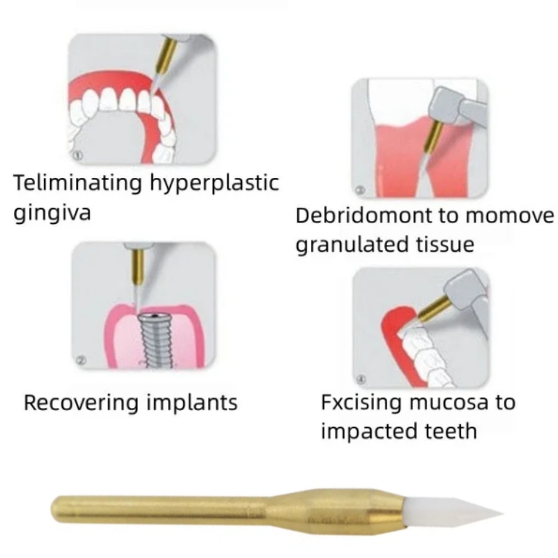 Diş Hekimliği Yumuşak Kesici F - Teeth Whitening Gum incelemesi ve fiyatı