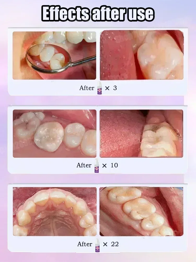 Diğer Diş Temizleme Ürünleri D - Teeth Whitening Toothpaste incelemesi ve fiyatı
