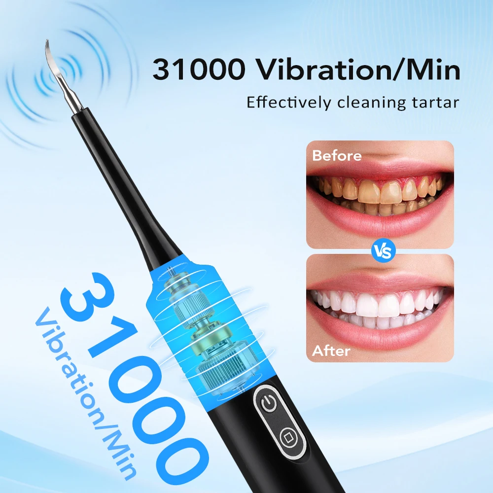 Elektrikli Sonik Titreşimli Di - Teeth Whitening Toothbrush incelemesi ve fiyatı